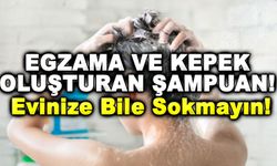 Egzama ve Kepek Oluşturan Şampuan! Evinize Bile Sokmayın!