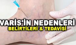 Ayak Varisi: Nedenleri, Belirtileri ve Tedavisi