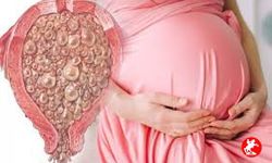 Mol Gebelik Nedir?