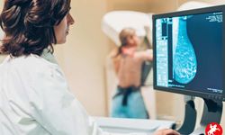 Yapay Zeka Destekli Mamografi Sistemiyle Kanser Teşhisinde Çığır Açıldı!