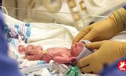 Prematüre Bebek Nedir?