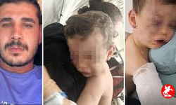 2 Yaşındaki Aren Bebek Yakmaya Çalışıldı
