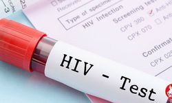 HIV Tedavisinde Devrim Niteliğinde Gelişme! Virüs İlk Kez Hücre İçinde Görülebildi
