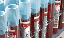 HIV'e Karşı Devrim Yaratan Yöntem! Virüs İlk Kez Saklandığı Yerden Çıkarıldı