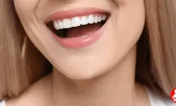 Gülüş Tasarımı