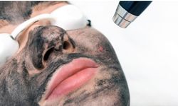 Cildinizi Yenilemenin En Etkili Yolları: Hangi Uygulama Size Uygun?