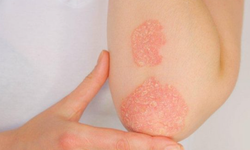 K Mexader Krem Ne İşe Yarar? Uzmanlardan Yeni Açıklamalar