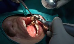 Samsun Çene Cerrahisi Doktorları