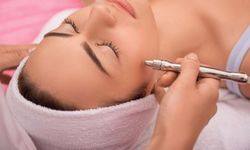 Samsun İğneli Epilasyon Fiyatları 2026