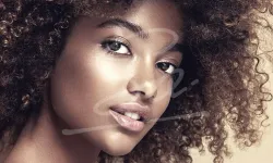 Çene Dolgusu Nedir? Yüz Hatlarına Etkisi