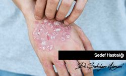 Cilt Rahatsızlıklarında Hangi Bölüme Gidilmelidir?