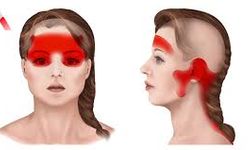 Stres Baş Ağrısı Nasıl Geçer? Günlük Hayatta Uygulanabilecek Etkili Yöntemler