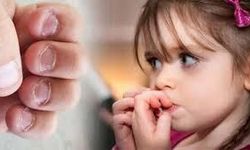Bebeğim Tırnaklarını Yiyor: Sebepleri ve Çözüm Önerileri