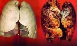 Sigara’yı Bırakma Günü Hangi Gün? Sigarayı Bırakmak İçin Tüyolar