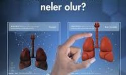 Sigara Bırakınca Vücutta Neler Değişir? Gün Gün Etkiler