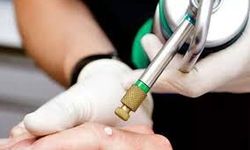 Soğuk Terapi (Kriyoterapi) Nedir?