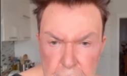 Kuşum Aydın Estetik Operasyon Geçirdi!