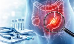 Rektum Kanseri Merak Edilenler: Belirtileri, Nedenleri, Tedavi Yöntemleri