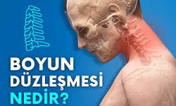 Boyun Düzleşmesi Neden Olur? Evde Yapılabilecek Egzersizler