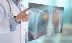 Prof. Dr. Alper Fındıkçıoğlu: “Sigara, akciğer sağlığını sessizce yok eden en büyük tehdittir”