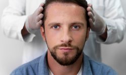 Antalya’da Saç Uygulamalarına İlgi Artıyor: DHI Tekniği, Mezoterapi Desteği ve Fiyat Araştırmaları Gündemde