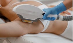 Ankara Lazer Epilasyon Merkezleri Arasında Doğru Klinik Seçimi