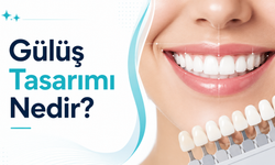 Gülüş Tasarımı Nedir