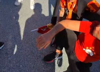 Video : Galatasaray Taraftarı Bacağından Vuruldu!!