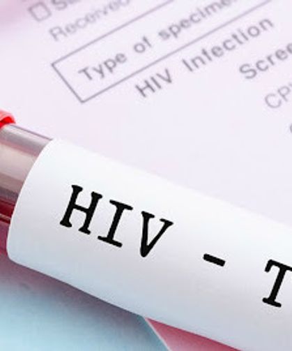 HIV Tedavisinde Devrim Niteliğinde Gelişme! Virüs İlk Kez Hücre İçinde Görülebildi