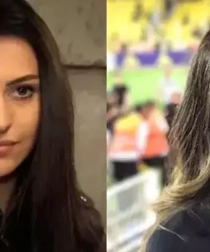 Yeni Hali Olay Oldu! Tuvana Türkay Yüz Gerdirme Operasyonuyla Gündemde