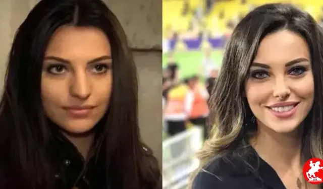 Yeni Hali Olay Oldu! Tuvana Türkay Yüz Gerdirme Operasyonuyla Gündemde