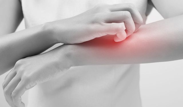 Bilim İnsanlarından Şok İstek: Dört Gıda Daha Alerjen Risk Listesine Eklenmeli!
