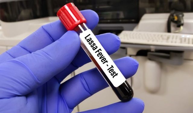 Lassa Ateşi Nijerya'da Can Almaya Devam Ediyor: 162 Ölü, Sayılar Artıyor!
