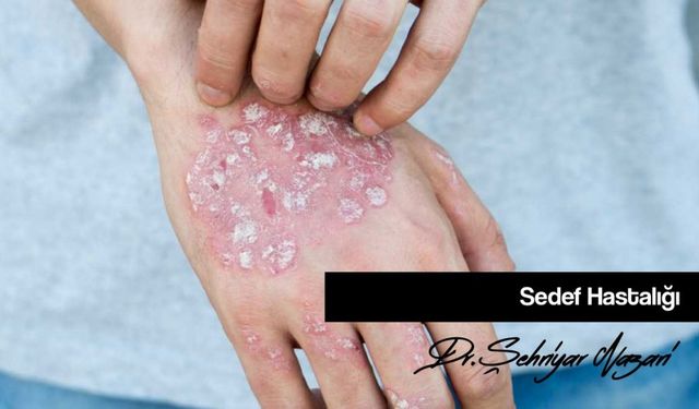 Cilt Rahatsızlıklarında Hangi Bölüme Gidilmelidir?