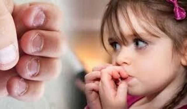 Bebeğim Tırnaklarını Yiyor: Sebepleri ve Çözüm Önerileri