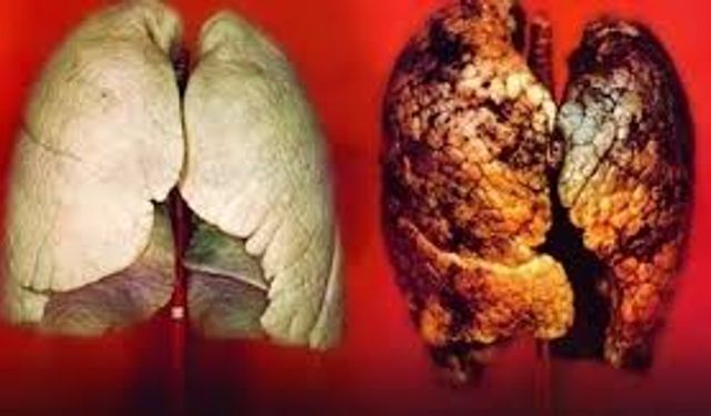 Sigara’yı Bırakma Günü Hangi Gün? Sigarayı Bırakmak İçin Tüyolar