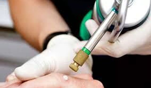 Soğuk Terapi (Kriyoterapi) Nedir?