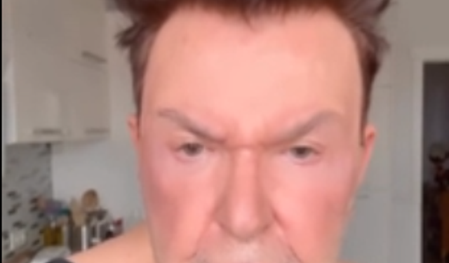 Kuşum Aydın Estetik Operasyon Geçirdi!