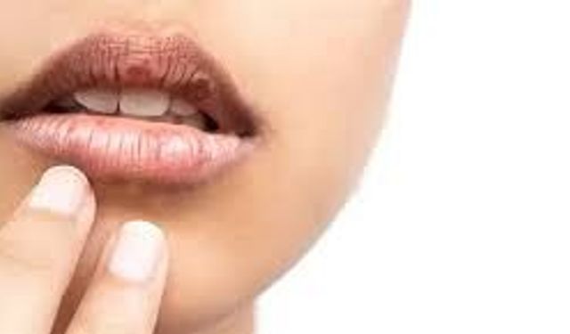 Sabahları Ağız Kuruluğu Neden Olur, Nasıl Önlenir?