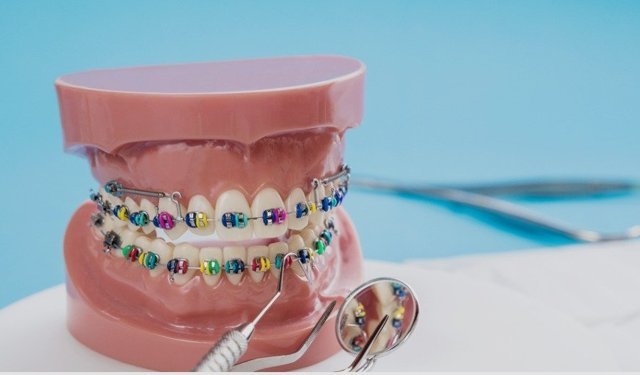 Periodontoloji Hizmetinde Uzman Seçerken Nelere Dikkat Edilmeli?