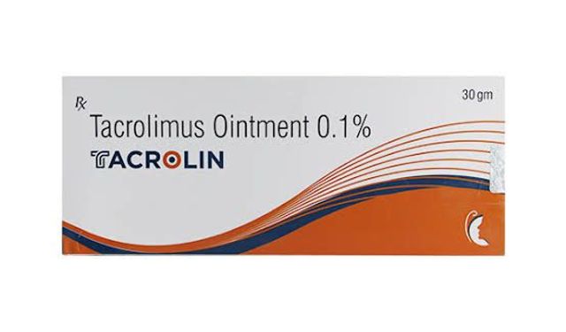 Tacrolin Krem Ne İşe Yarar? Kortizonlu mu, Nasıl Kullanılır?
