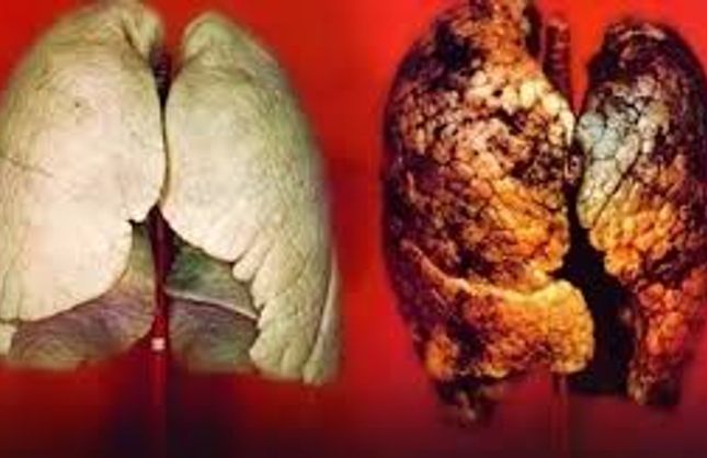 Sigara’yı Bırakma Günü Hangi Gün? Sigarayı Bırakmak İçin Tüyolar