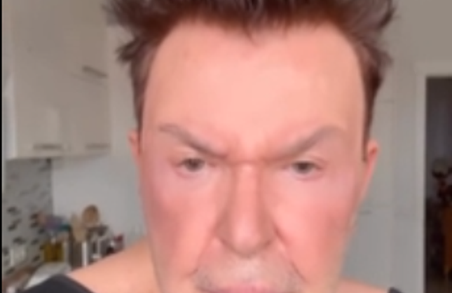 Kuşum Aydın Estetik Operasyon Geçirdi!