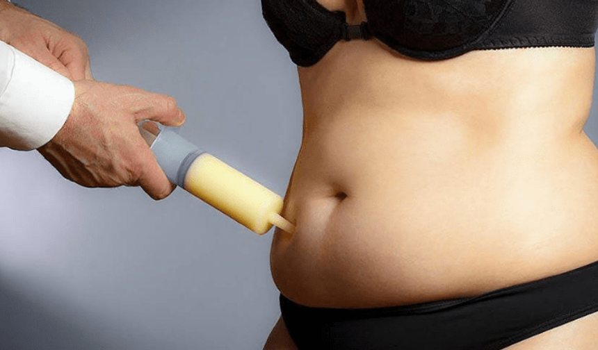 Liposuction: Sağlıklı Bir Yöntem Olabilir Ancak Bu Faktörlere Dikkat Etmek Gerekir! 