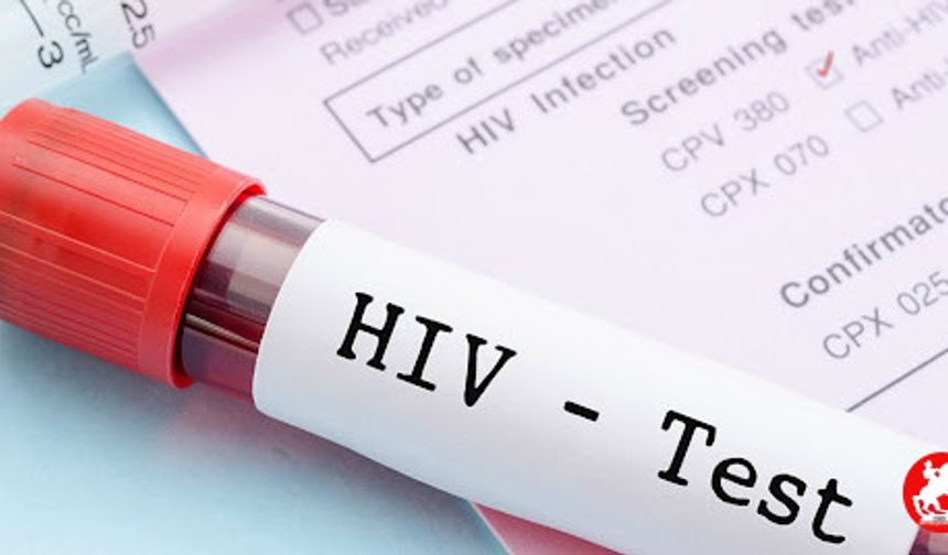 HIV Tedavisinde Devrim Niteliğinde Gelişme! Virüs İlk Kez Hücre İçinde Görülebildi
