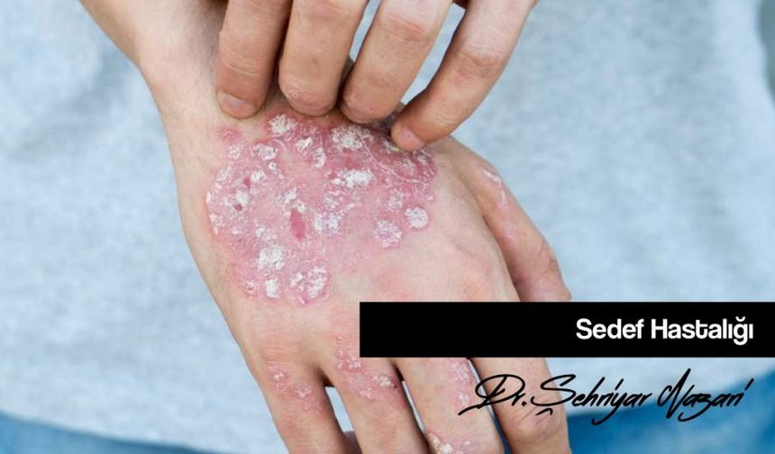 Cilt Rahatsızlıklarında Hangi Bölüme Gidilmelidir?